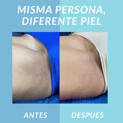 Jelly Booster Aceite Anti-Manchas y Pigmentacion