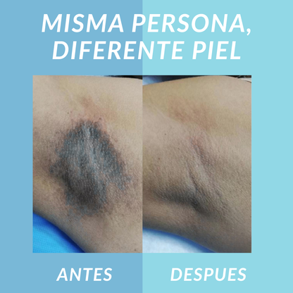 Jelly Booster Aceite Anti-Manchas y Pigmentacion