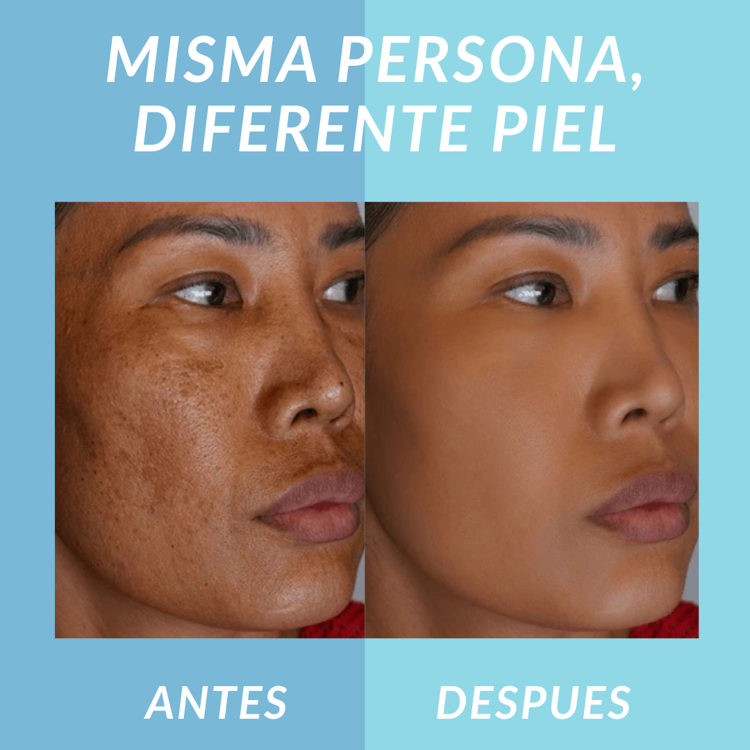 Jelly Booster Aceite Anti-Manchas y Pigmentacion