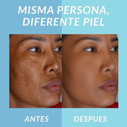 Jelly Booster Aceite Anti-Manchas y Pigmentacion