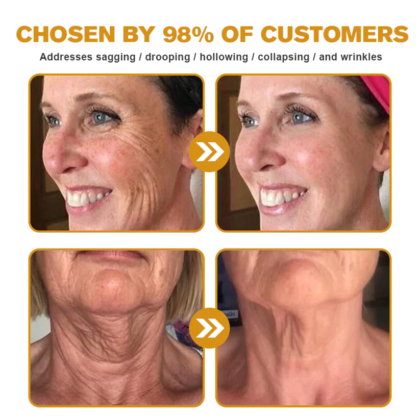 ✨FDA Approved:LOVILDS™  Bee Venom Skin Restoration Cream — 🔥Limited Time 70% OFF🔥